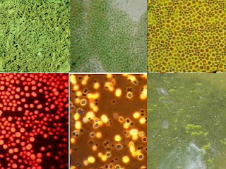 Cyanobacteria-Types.jpg