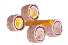 Artery small.jpg