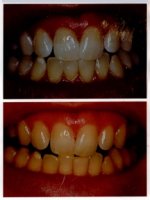 look what eco aqualizer did for my teeth.jpg