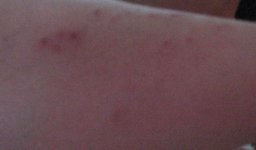 hammer sting 001.JPG