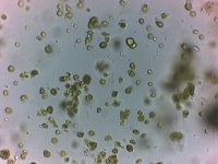 Bubble Algae Spores x400.jpg